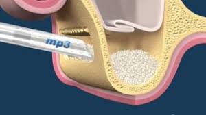 Mp3